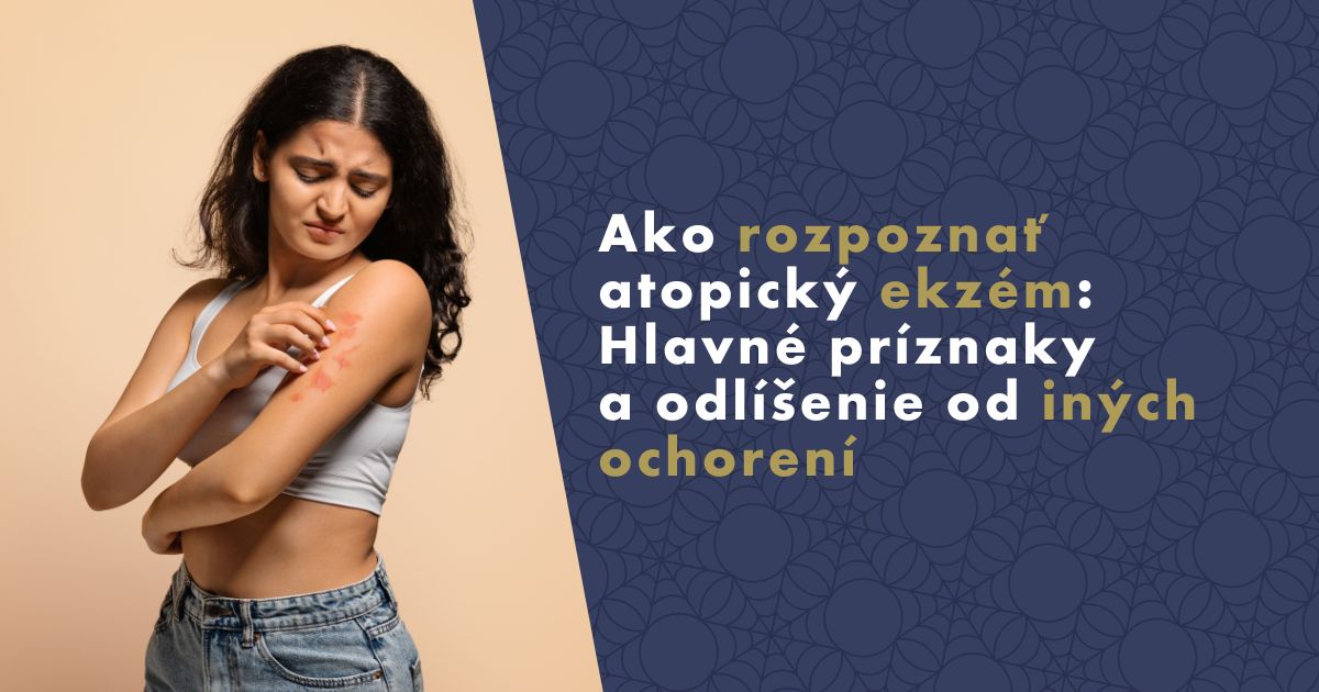 ako-rozpoznat-atopicky-ekzem (1)